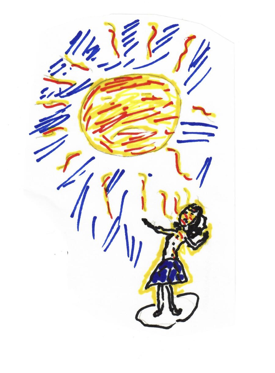 sun burn